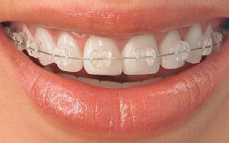 Burhan Demirel Düzce Diş Doktoru Ortodonti Tedavi Yöntemleri