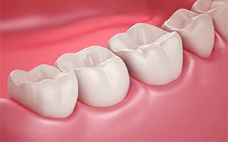 Burhan Demirel Düzce Diş Doktoru Konservatif Diş Tedavisi
